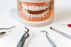 professional dental cleaning warner robins