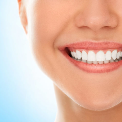 A woman is smiling while being at the dentist